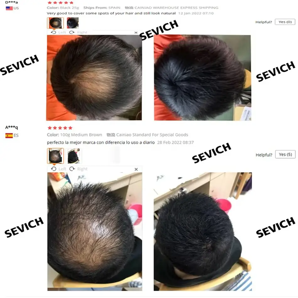 Sevich Hair Fiber Set – 3PCS Keratin Hair Building Fibers + Styling Spray + Precision Nozzle for Hair Loss & Thicker Look